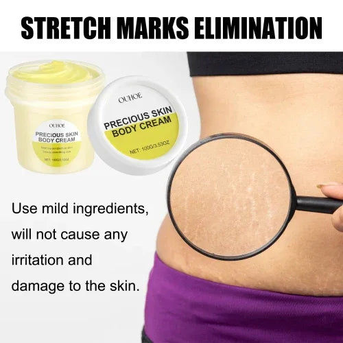 Ouhoe Pregnancy Care Cream Moisturizes Restores Fine Lines Of Postpartum To Firm Soft And Smooth Body Skin - My Vixen Vault