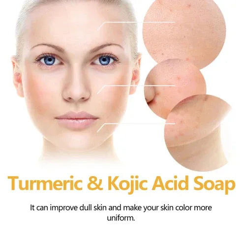 EELHOE Turmeric Kojic Acid Soap Gently Clean Face Fade Spots Brighten Tone And Moisturize Even Skin - My Vixen Vault