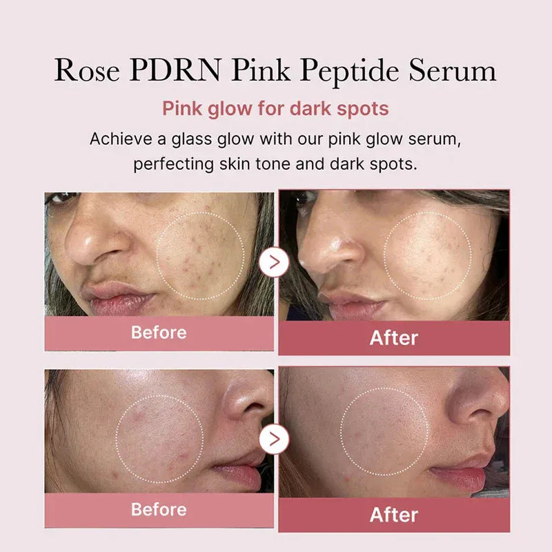 Korean Glow: Pdrn Collagen & Salmon DNA Serum - My Vixen Vault