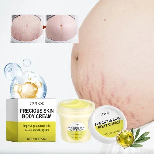 Ouhoe Pregnancy Care Cream Moisturizes Restores Fine Lines Of Postpartum To Firm Soft And Smooth Body Skin - My Vixen Vault