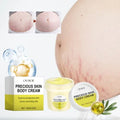 Ouhoe Pregnancy Care Cream Moisturizes Restores Fine Lines Of Postpartum To Firm Soft And Smooth Body Skin - My Vixen Vault