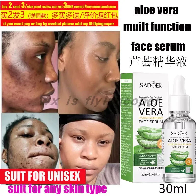 Aloe Vera Face Cream Day Night Acne Oil Control Whitening Cream.