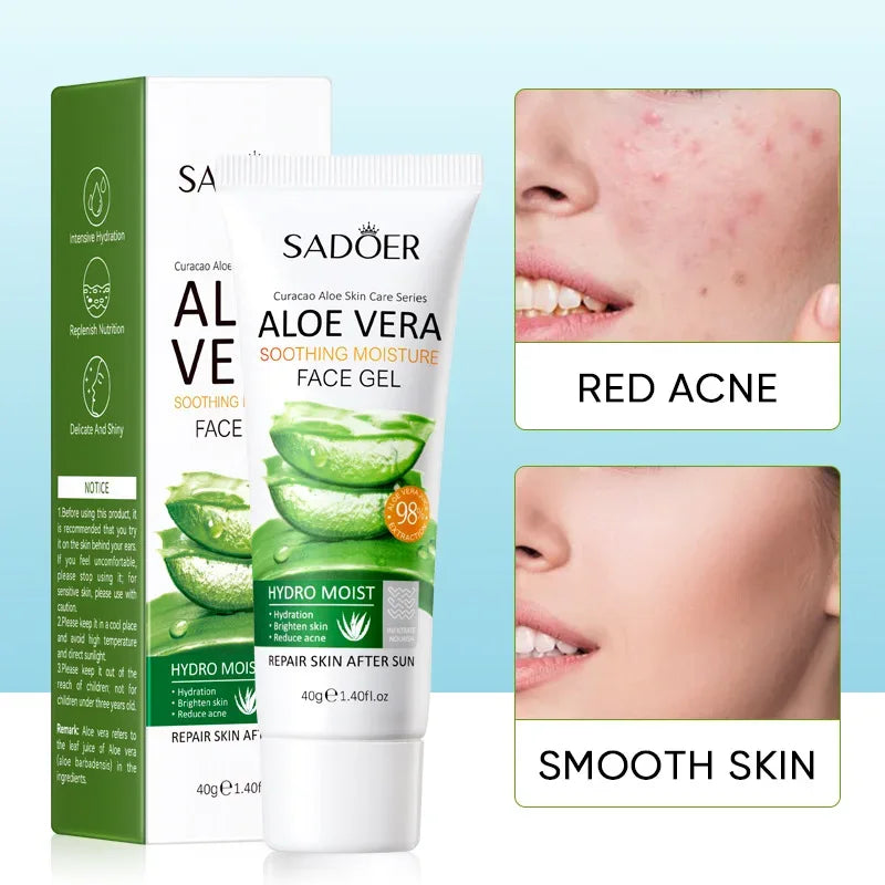 SADOER Aloe Vera Gel for Anti Acne & Hydrating Face Care. - 