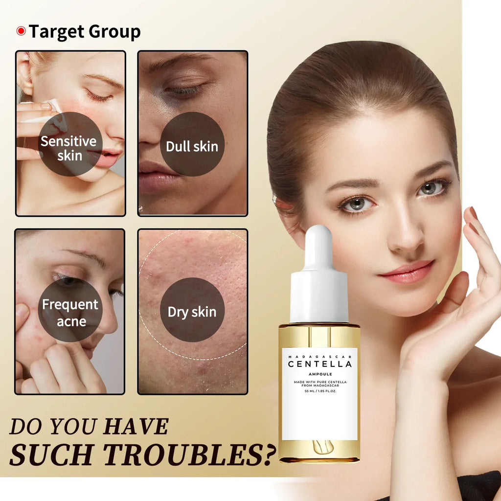 Madagascar Centella Asiatica Serum 55ml - Sensitive skin soothing formula with acne fighting，deep moisturizing benefits for face - My Vixen Vault