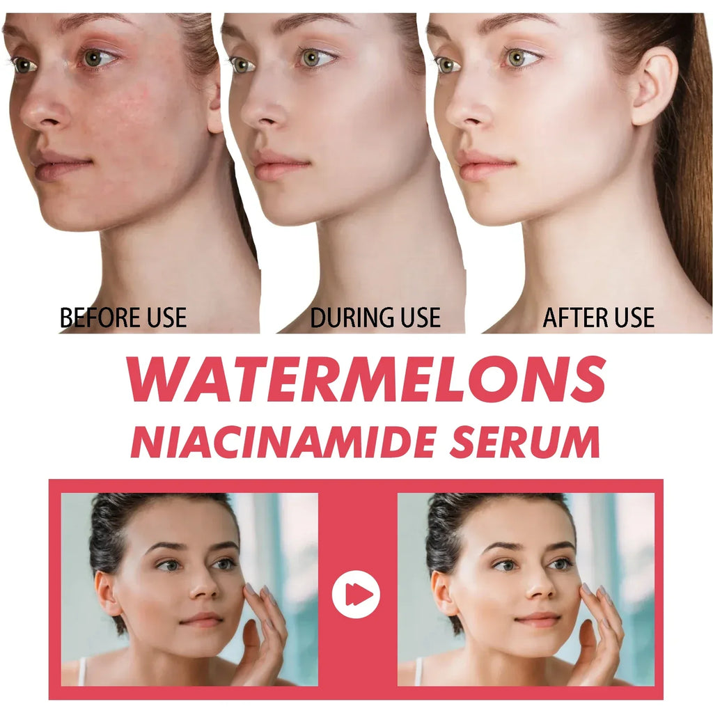 Watermelon Niacinamide Brightening Essence Light Bulb Design W/ Hyaluronic Acid Vitamin E Lightweight Hydrating Face Makeup - My Vixen Vault