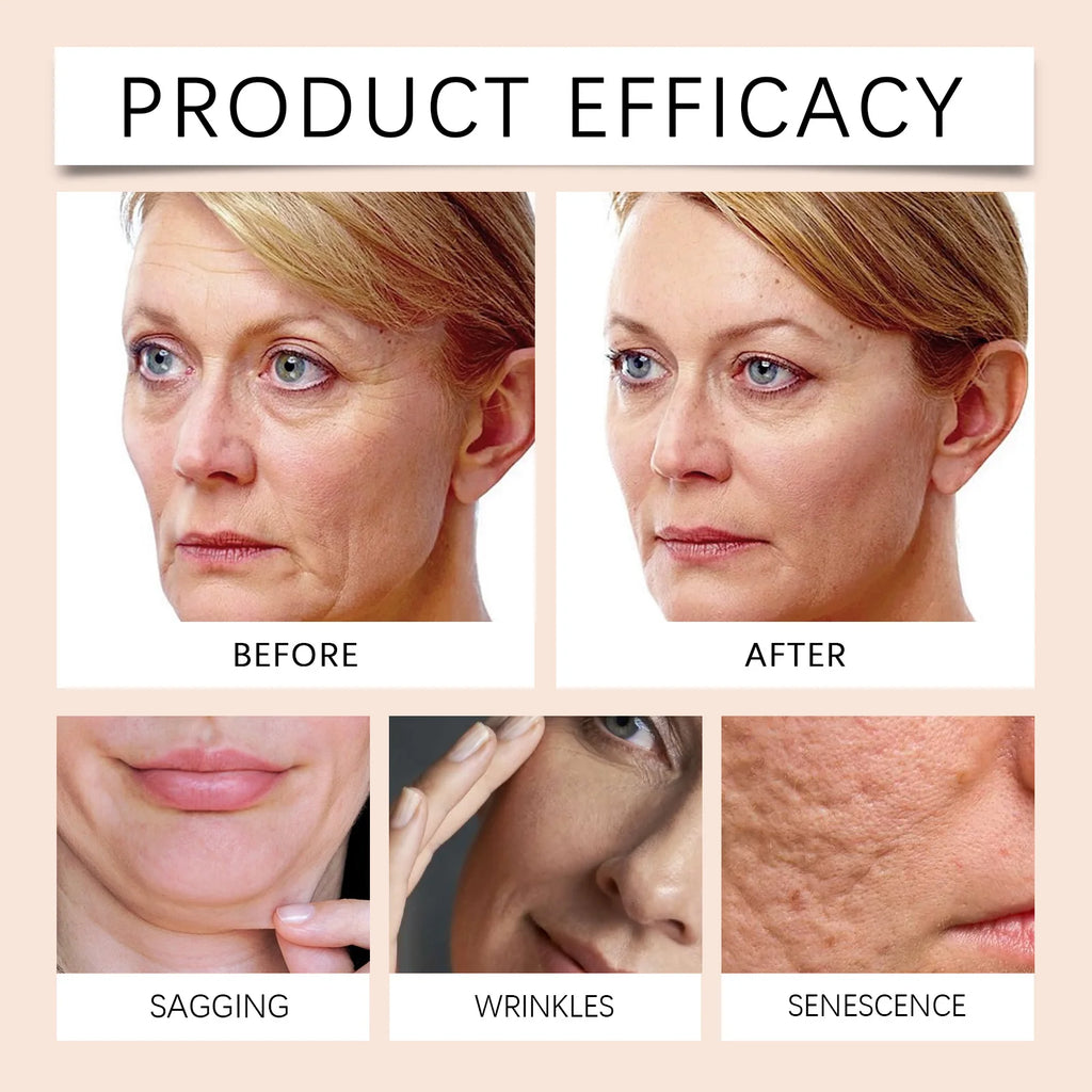 HOYGI Bee Venom Cream Stick Nourishing Firming Skin Fade Fine Lines Reduce Wrinkles Increase Elasticity Revitalizing Skin Care - Beauty Collection Studio