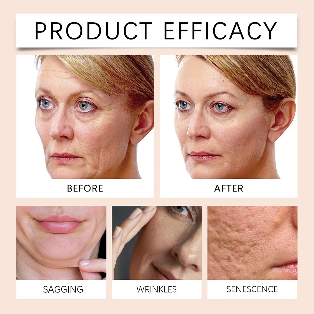 HOYGI Bee Venom Cream Stick Nourishing Firming Skin Fade Fine Lines Reduce Wrinkles Increase Elasticity Revitalizing Skin Care - Beauty Collection Studio
