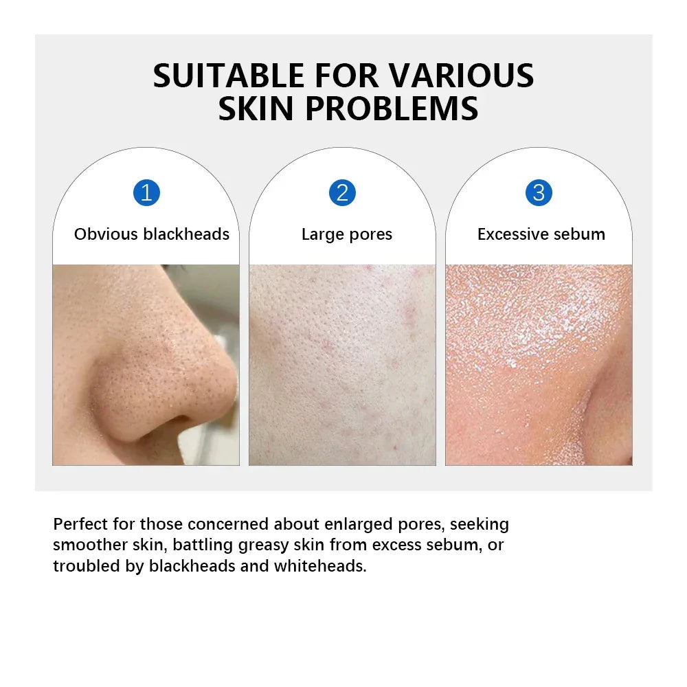 ZeroPore 2X Exfoliate & Smooth Toner Pads (70ct) - My Vixen Vault