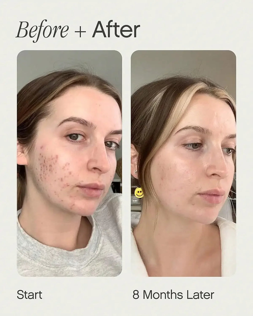 Fade, whiten and clear essence | reduce spots and spots - My Vixen Vault