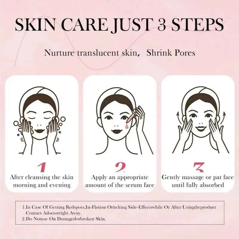 Niacinamide Serum Dark Spot Remover Fade Acne Marks Hyperpigmentation Shrink Pores Even Skin Tone Moisturizing Korea Skin Care 3