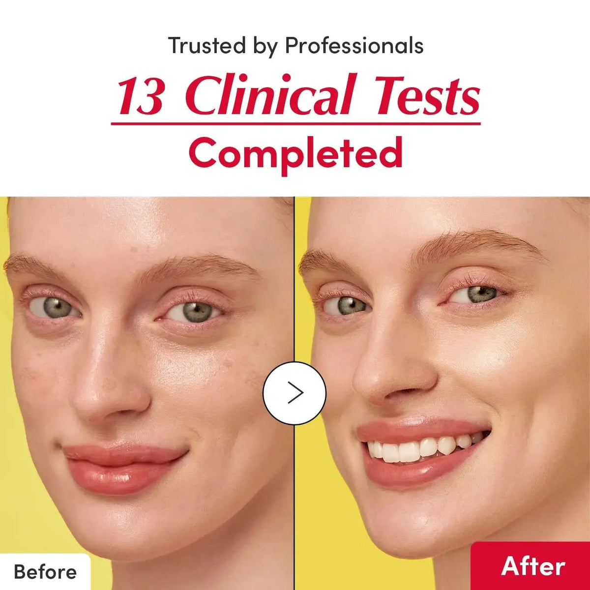Vitamin whitening serum, niacinamide vitamin C serum, bakuchiol plumping serum, shrink pores, reduce wrinkles, and lift skin - My Vixen Vault
