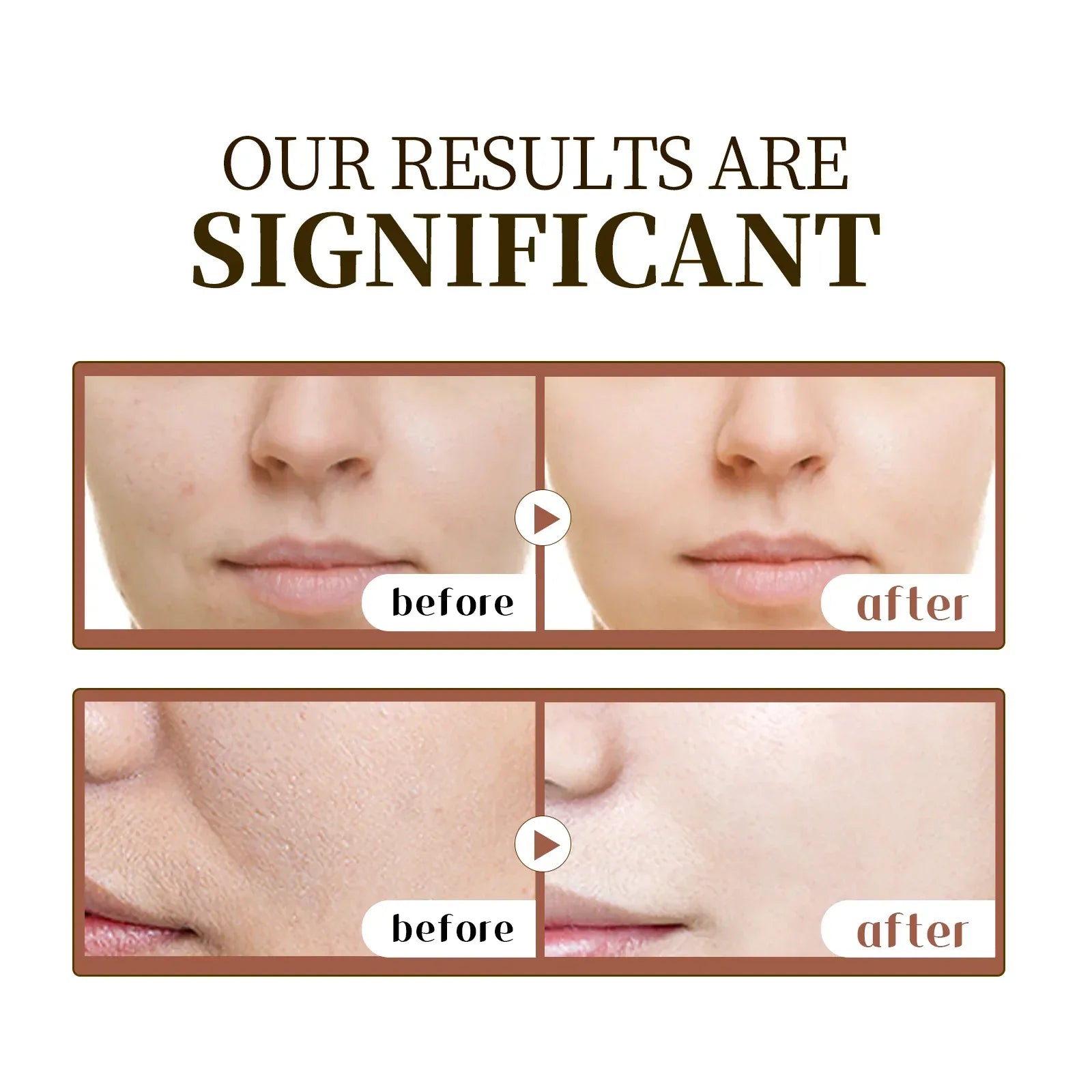 Madagascar Centella Asiatica Serum 55ml - Sensitive skin soothing formula with acne fighting，deep moisturizing benefits for face - My Vixen Vault