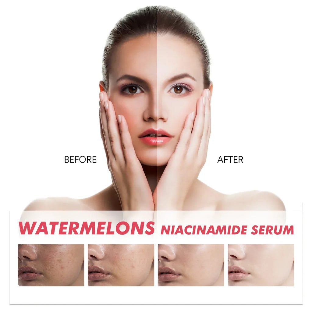 Watermelon Niacinamide Brightening Essence Light Bulb Design W/ Hyaluronic Acid Vitamin E Lightweight Hydrating Face Makeup - My Vixen Vault