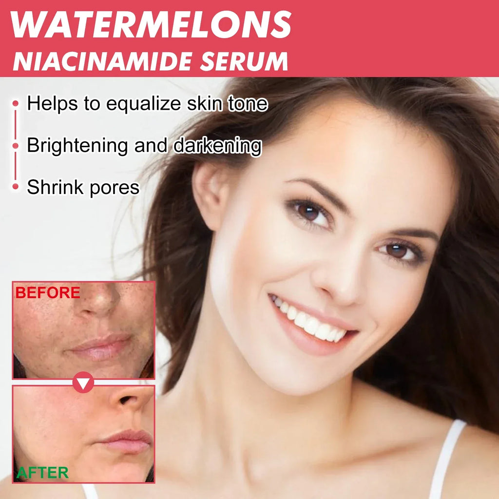 Watermelon Niacinamide Brightening Essence Light Bulb Design W/ Hyaluronic Acid Vitamin E Lightweight Hydrating Face Makeup - My Vixen Vault